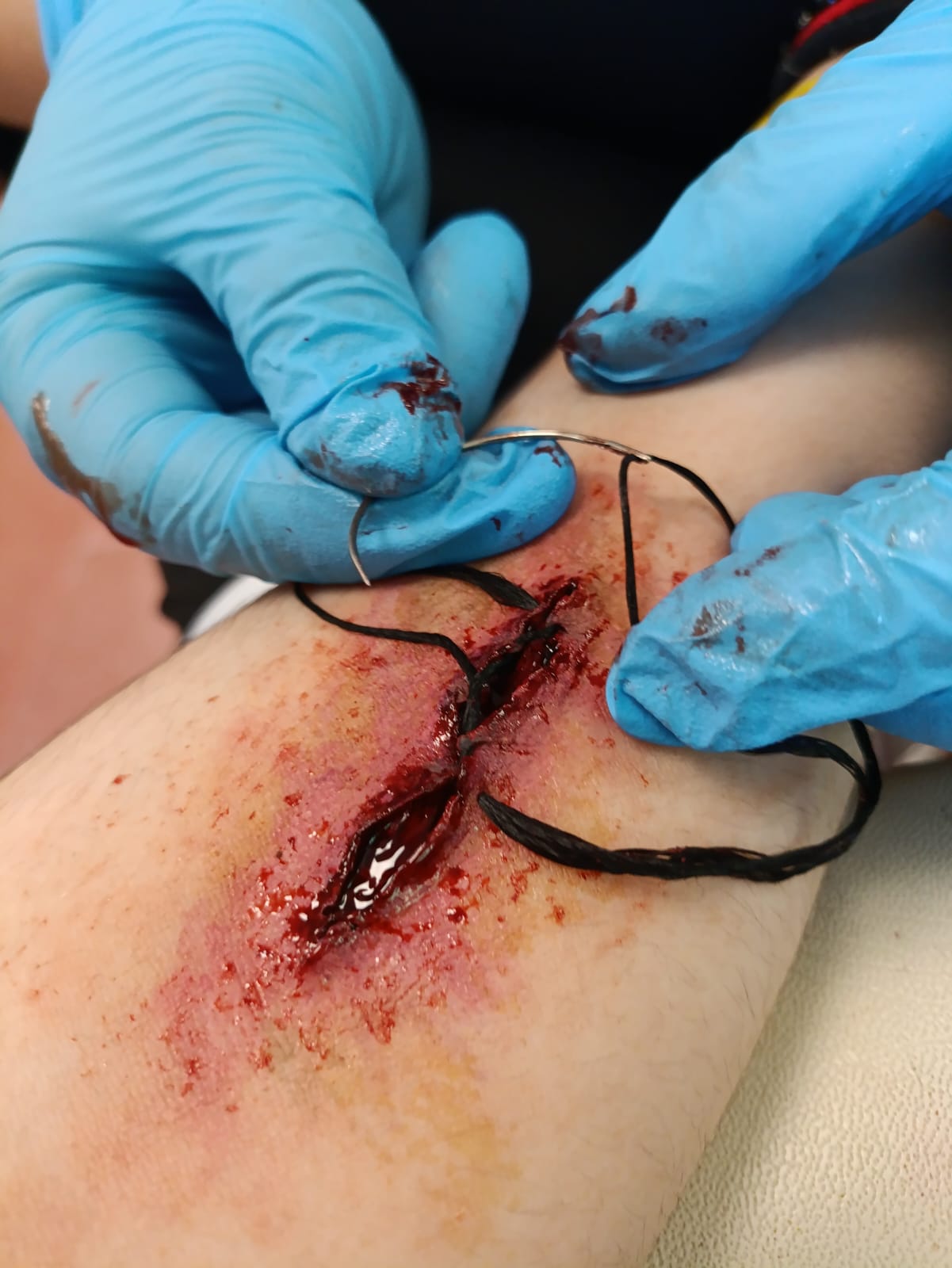 Aplicación manual de detalles en herida de efectos especiales