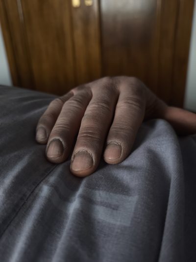 Fenómenos cadavéricos FX: detalle de texturas y alteraciones cadavéricas
