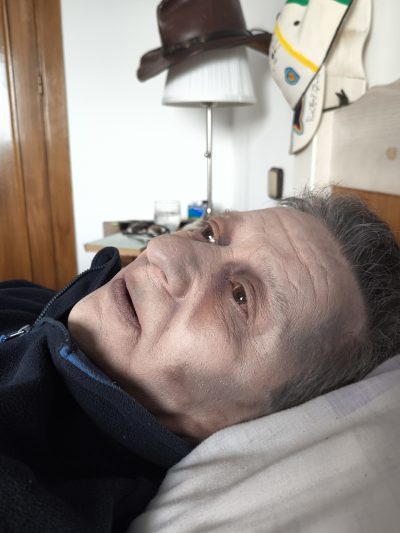 Fenómenos cadavéricos FX: vista lateral del efecto de envenenamiento simulado
