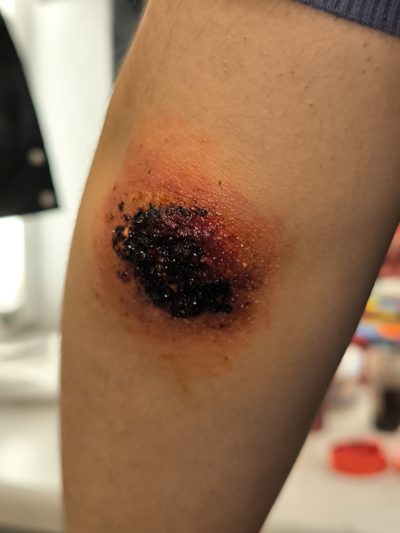 Rozadura FX: abrasión cutánea con mastic, Supra y sangre artificial